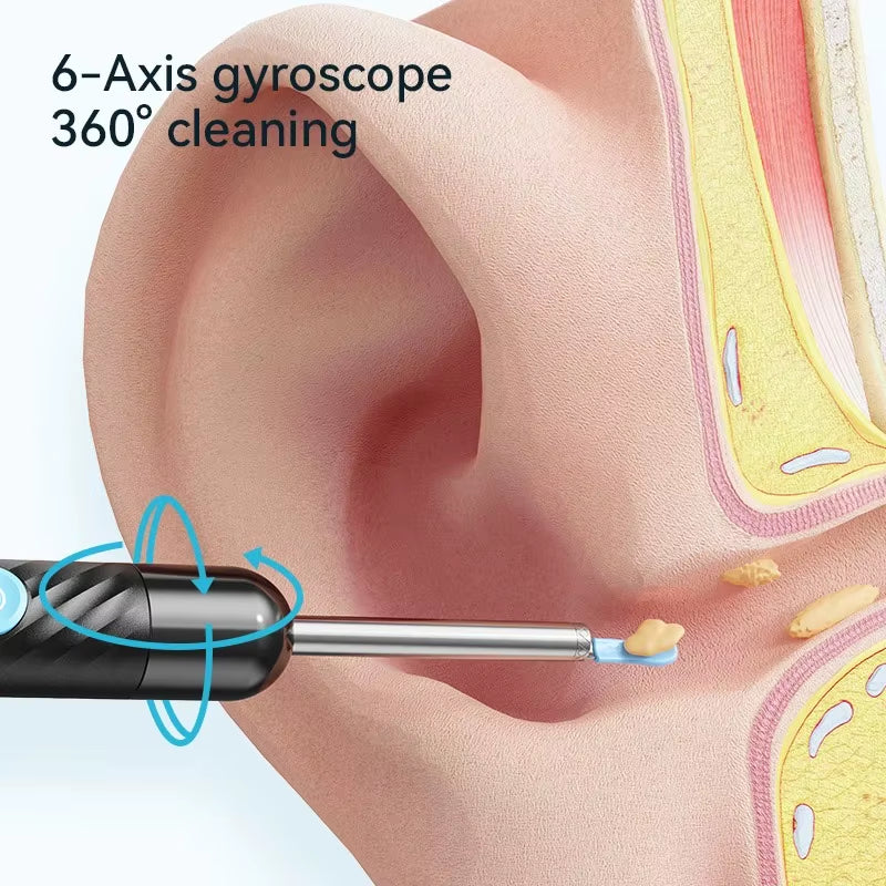 Wireless Ear Wax Removal with Camera Rechargeable Ear Cleaner 8 Megapixels Check Camera with Ear Spoon Set Canal Clean